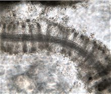 Thioploca streng 2a